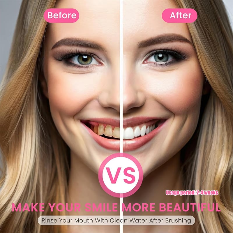 Niacinamide Whitening Toothpaste - For Healthier, Whiter Teeth!