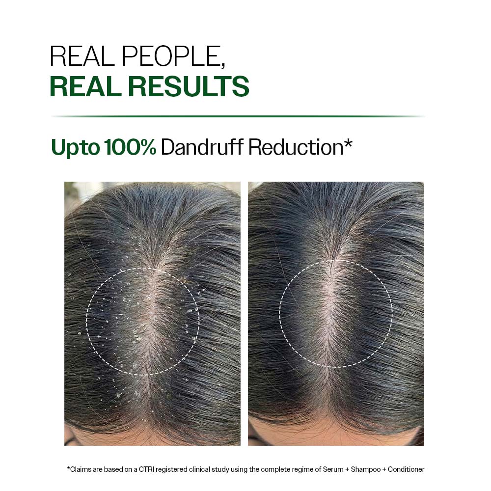 Anti Dandruff Shampoo with Salicylic Acid, Piroctone Olamine & Biotin - 750 ml | Pack of 2