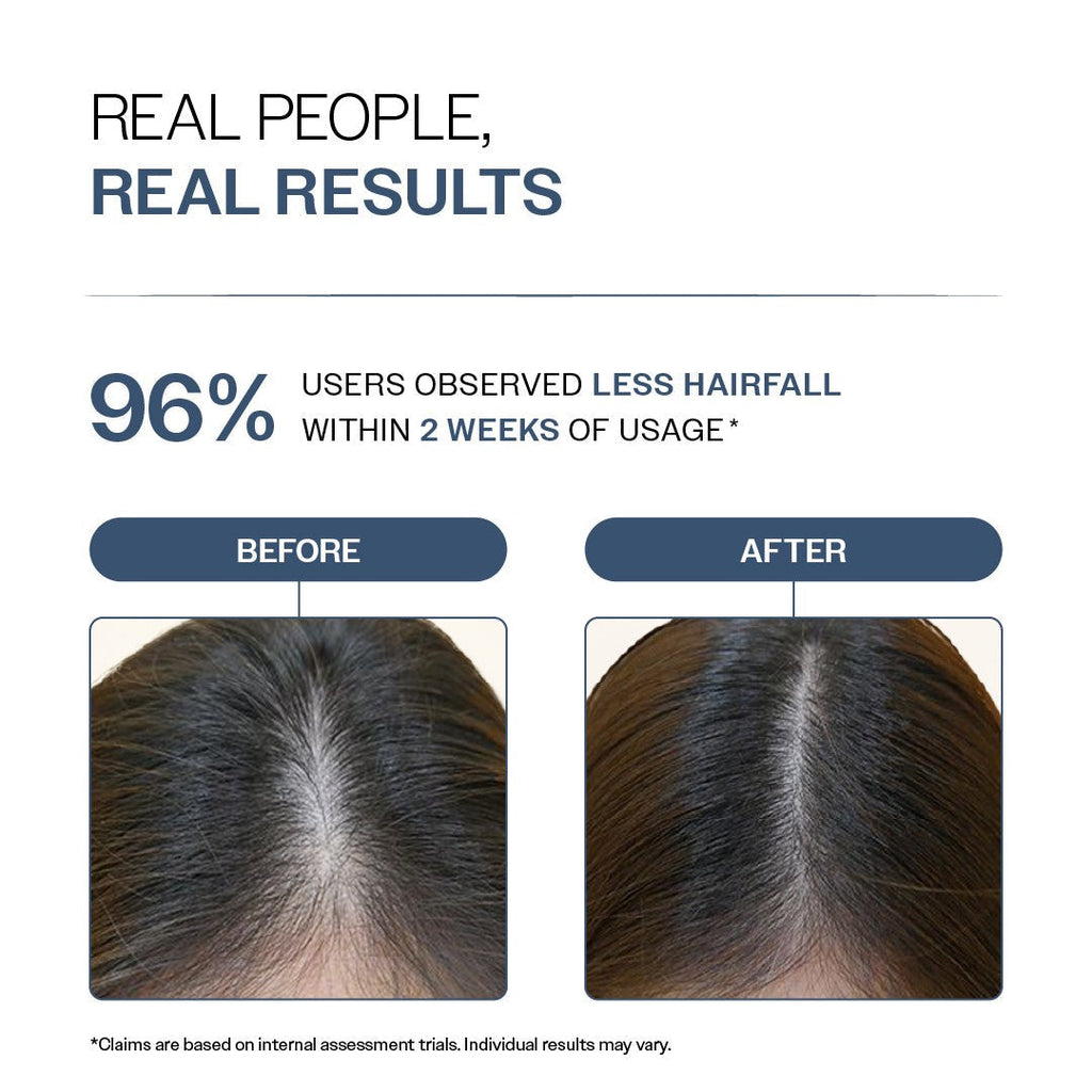 Anti-Hair Fall Shampoo with Adenosine & Peptides - 250 ml  | Pack of 2