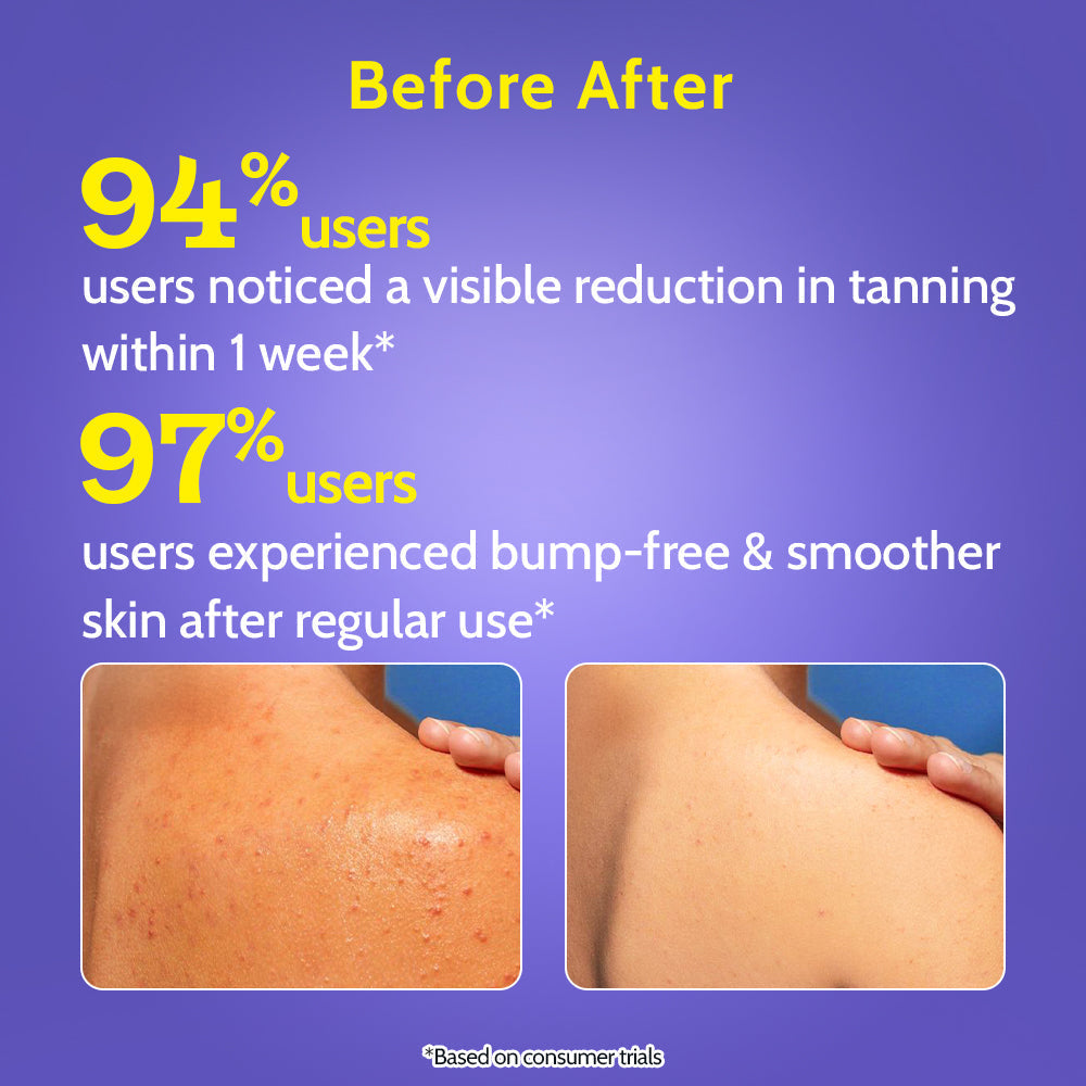 Exfoliating Body Wash with Lactic Acid & Salicylic Acid with Loofah - 236 ml