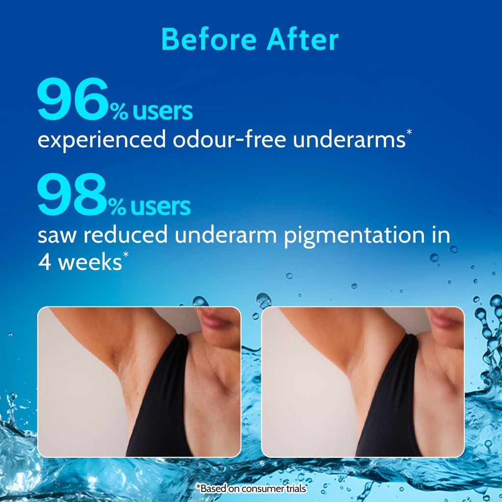 Underarm Roll On for Odour Control & Pigmentation (White Jasmine) - 40 ml | Pack of 3