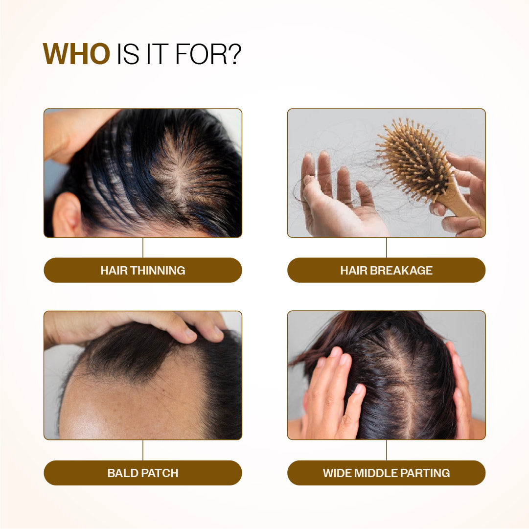Hair Growth Serum (30 ml) & Anti-Hairfall Shampoo (100 ml) Combo