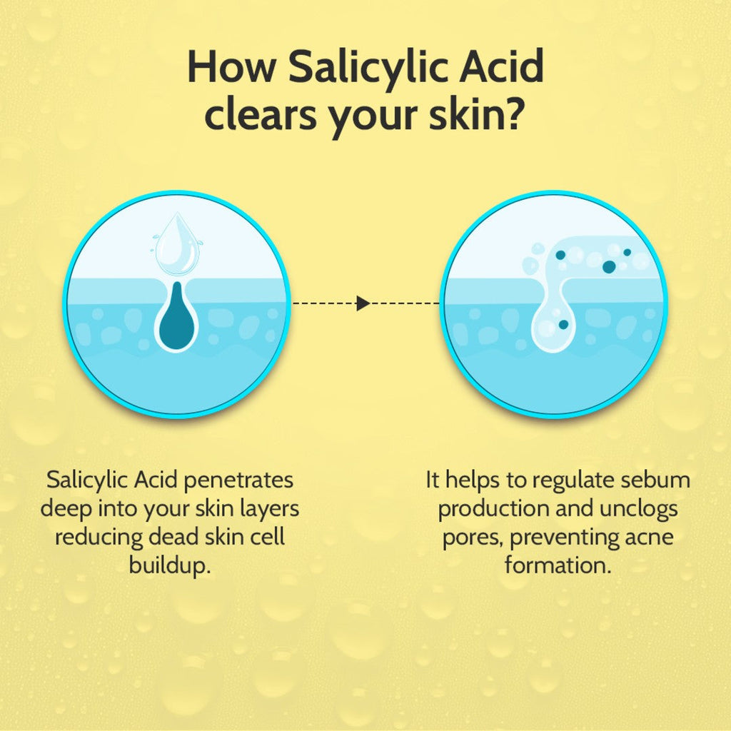 2% Salicylic Acid Face Serum for Acne Control - 10 ml