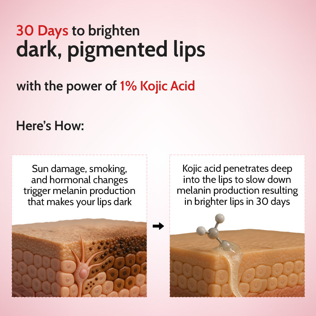 Cherry Lip Balm for Chapped & Pigmented Lips | SPF 50 PA++++ & Kojic Acid | 4.5 gm | Pack of 2