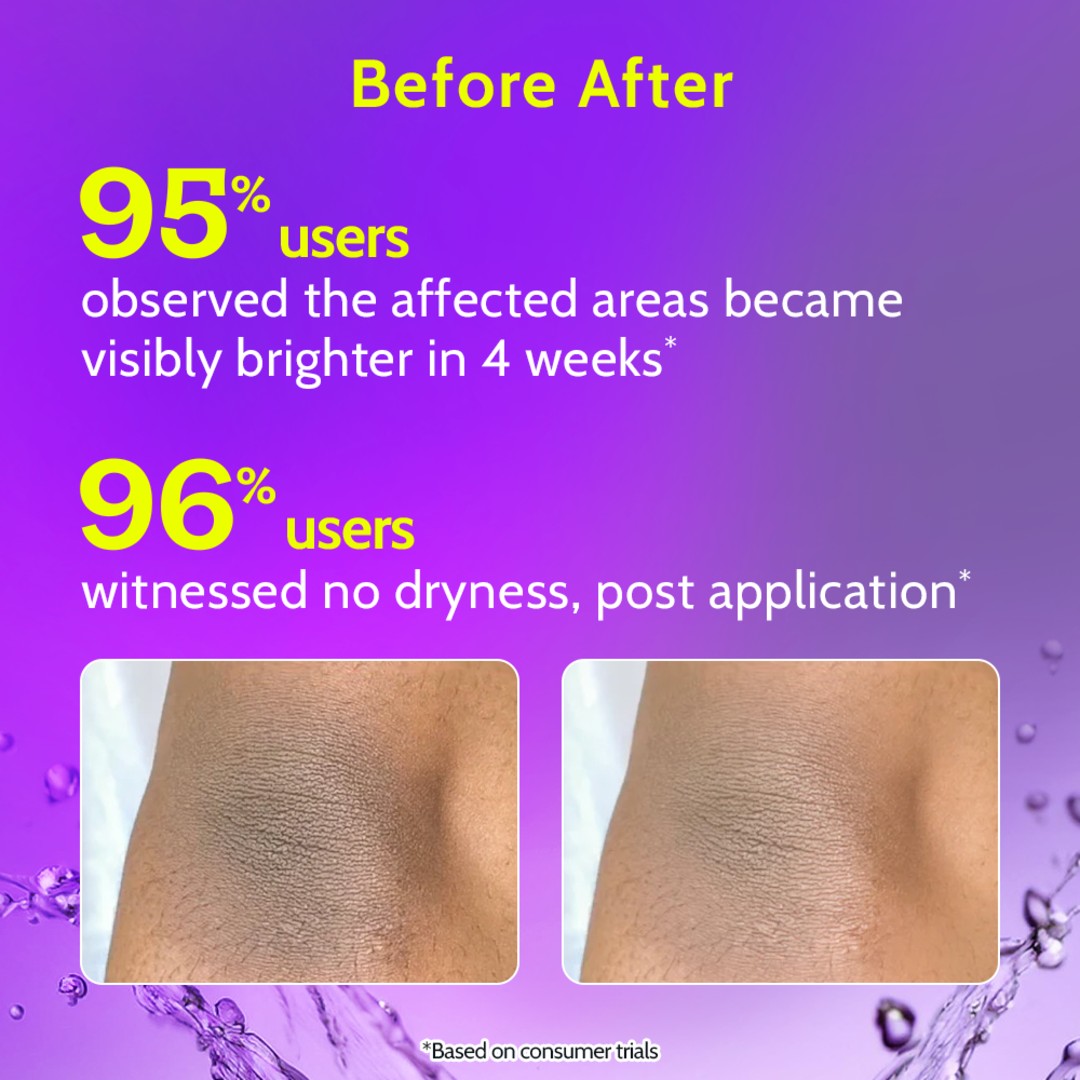 Neck Knee Roll On (40 ml) + Underarm Roll On Aqua (40 ml)