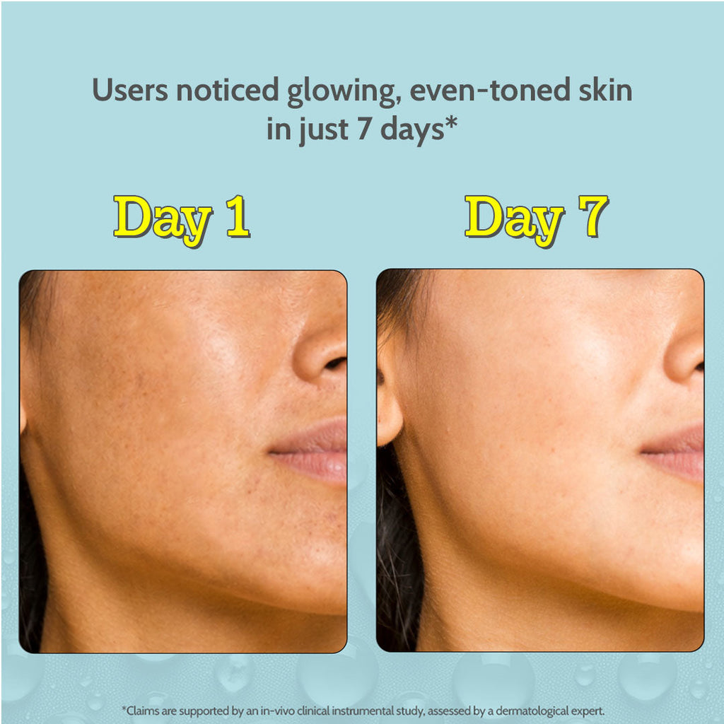 10% Vitamin C Serum for Glowing & Bright Skin - 30 ml